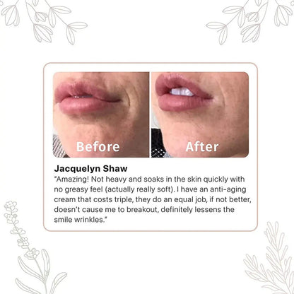 Retinol Cream 100gm Pack of 2